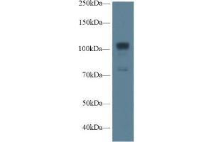 Western Blot; Sample: Human A549 cell lysate; Primary Ab: 1µg/ml Rabbit Anti-Rat NOS1 Antibody Second Ab: 0. (NOS1 抗体  (AA 468-616))
