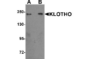 Western Blotting (WB) image for anti-Klotho (KL) (Middle Region) antibody (ABIN1030975) (Klotho 抗体  (Middle Region))