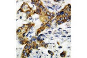 Anti-BAK antibody, IHC(P) IHC(P): Rat Lung Tissue (BAK1 抗体  (Middle Region))