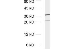 Western Blotting (WB) image for anti-Voltage-Dependent Anion Channel 1 (VDAC1) (AA 2-16) antibody (ABIN1742542)