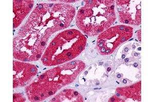 Immunohistochemistry (IHC) image for anti-Prostaglandin E Receptor 2 (Subtype EP2), 53kDa (PTGER2) (N-Term) antibody (ABIN1048568)