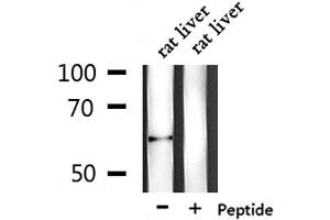 Western blot analysis of extracts from rat liver, using PLAT Antibody. (PLAT 抗体  (C-Term))