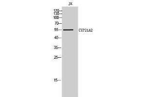 Western Blotting (WB) image for anti-Cytochrome P450, Family 21, Subfamily A, Polypeptide 2 (CYP21A2) (Internal Region) antibody (ABIN3184165) (CYP21A2 抗体  (Internal Region))
