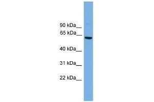 WB Suggested Anti-Cbfa2t2 Antibody Titration:  0.