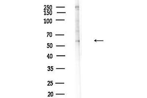 Western blot analysis of lysates from F10-LUC cells(heat-shock,45 min treatment), using Phospho-AK (Ser124) Antibody at 1/1000 dilution.