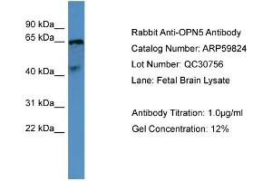 WB Suggested Anti-OPN5  Antibody Titration: 0. (OPN5 抗体  (C-Term))