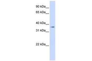 Image no. 1 for anti-Transmembrane Protein 30B (TMEM30B) (AA 108-157) antibody (ABIN6740901) (TMEM30B 抗体  (AA 108-157))