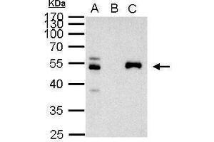 IP Image PAX8 antibody immunoprecipitates PAX8 protein in IP experiments. (PAX8 抗体)