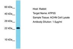 Image no. 1 for anti-ATP Synthase, H+ Transporting, Mitochondrial F0 Complex, Subunit S (Factor B) (ATP5S) (AA 71-120) antibody (ABIN6750597)