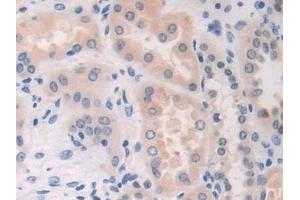 Detection of CDA in Human Kidney Tissue using Polyclonal Antibody to Cytidine Deaminase (CDA) (CDA 抗体  (AA 2-146))