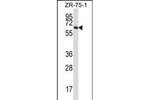P17 Antibody (C-term) (ABIN657916 and ABIN2846863) western blot analysis in ZR-75-1 cell line lysates (35 μg/lane). (MMP17 抗体  (C-Term))