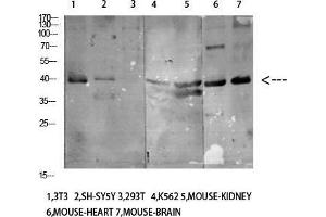 Western Blot (WB) analysis of specific cells using Antibody diluted at 1:1000. (KIR3DL1 抗体)