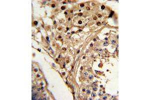Formalin-fixed and paraffin-embedded human testis tissue reacted with KLF6 Antibody , which was peroxidase-conjugated to the secondary antibody, followed by DAB staining. (KLF6 抗体  (C-Term))
