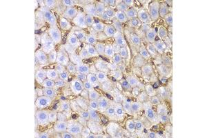 Immunohistochemistry (IHC) image for anti-Major Histocompatibility Complex, Class I, A (HLA-A) antibody (ABIN1873024)