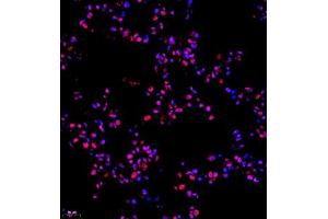 Immunofluorescence of paraffin embedded rat lung using RB1 (ABIN7075477) at dilution of 1:1400 (400x lens)