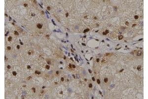 ABIN6269310 at 1/100 staining Human liver tissue by IHC-P.