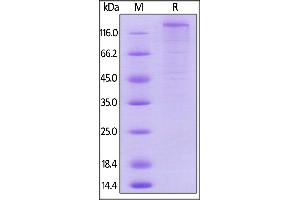 Mouse VEGF R1, Mouse IgG2a Fc Tag, low endotoxin on  under reducing (R) condition. (FLT1 Protein (AA 23-759) (Fc Tag))