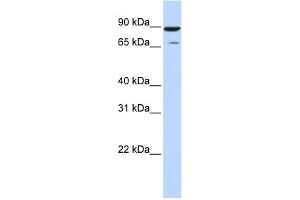 WB Suggested Anti-HIPK4 Antibody Titration: 0. (HIPK4 抗体  (Middle Region))