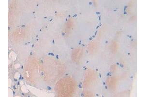 DAB staining on IHC-P; Samples: Mouse Skeletal muscle Tissue (Myosin IB 抗体  (AA 779-1040))