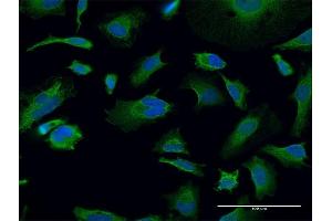 Immunofluorescence of monoclonal antibody to TGM2 on HeLa cell. (Transglutaminase 2 抗体  (AA 1-120))