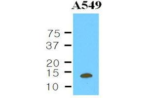 Western Blotting (WB) image for anti-Cystatin B (Stefin B) (CSTB) (AA 1-98), (N-Term) antibody (ABIN263931) (CSTB 抗体  (N-Term))