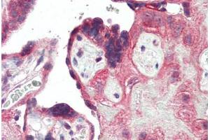 Human Placenta (formalin-fixed, paraffin-embedded) stained with TLR3 antibody ABIN461896 at 5 ug/ml followed by biotinylated goat anti-rabbit IgG secondary antibody ABIN481713, alkaline phosphatase-streptavidin and chromogen. (TLR3 抗体  (C-Term))