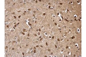 IHC-P Image DDB1 antibody [C3], C-term detects DDB1 protein at cytosol and nucleus on mouse hind brain by immunohistochemical analysis. (DDB1 抗体  (C-Term))