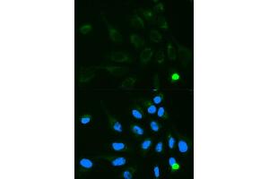 Immunofluorescence analysis of MCF7 cell using UGT1A9 antibody. (UGT1A9 抗体  (AA 26-250))