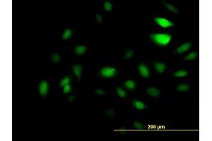 Immunofluorescence of monoclonal antibody to GCN5L2 on HeLa cell. (KAT2A 抗体  (AA 738-837))