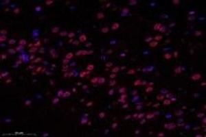 Immunofluorescent analysis of paraformaldehyde-fixed rat hippocampus using SUN2 (ABIN7075502) at dilution of 1: 1000