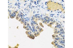 Immunohistochemistry of paraffin-embedded Mouse lung using ANGPT1 Polyclonal Antibody at dilution of 1:100 (40x lens). (Angiopoietin 1 抗体)