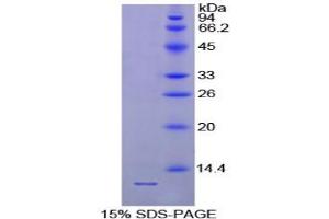 SDS-PAGE analysis of Chicken Parathyroid Hormone Protein. (PTH 蛋白)