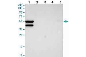 Western blot analysis of Lane 1: RT-4, Lane 2: U-251 MG, Lane 3: Human Plasma, Lane 4: Liver, Lane 5: Tonsil with MKS1 polyclonal antibody . (MKS1 抗体)
