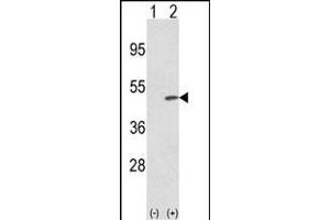 Western blot analysis of TRIB2 (arrow) using rabbit polyclonal TRIB2 N-term (ABIN652876 and ABIN2842567). (TRIB2 抗体  (N-Term))