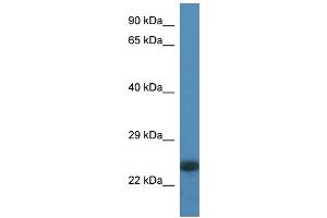 WB Suggested Anti-LOC100359980 Antibody Titration: 1. (LOC100359980 抗体  (N-Term))