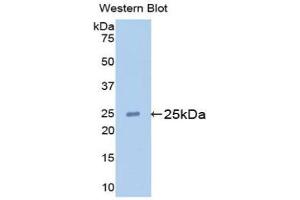 Detection of Recombinant APOM, Mouse using Polyclonal Antibody to Apolipoprotein M (APOM) (Apolipoprotein M 抗体  (AA 20-190))