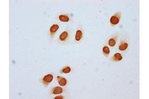 Immunocytochemistry analysis of ABIN7139202 diluted at 1:5 and staining in Hela cells (treated with 30mM sodium butyrate for 4h) performed on a Leica BondTM system. (Histone H2B 抗体  (acLys85))