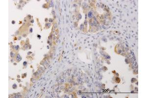 Immunostaining (ISt) image for anti-Myosin 9 (MYH9) (AA 131-220) antibody (ABIN518147)