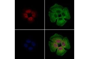 ABIN7094562 and ABIN7098611 staining Hela cells by IF/ICC.
