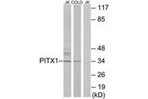 Western Blotting (WB) image for anti-Paired-Like Homeodomain 1 (PITX1) (AA 121-170) antibody (ABIN2889533) (PITX1 抗体  (AA 121-170))