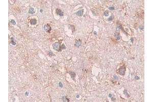 Immunohistochemistry (IHC) image for anti-Tripeptidyl Peptidase I (TPP1) (AA 1-320) antibody (ABIN7435157)