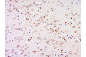 Immunohistochemistry (Paraffin-embedded Sections) (IHC (p)) image for anti-5-Methylcytosine antibody (ABIN1385081)
