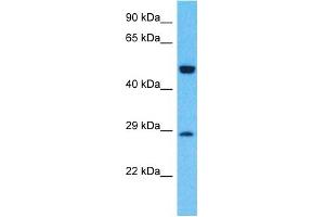 Host:  Rabbit  Target Name:  GLRB  Sample Type:  Fetal Lung lysates  Antibody Dilution:  1. (GLRB 抗体  (N-Term))