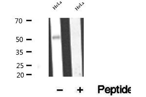 Western blot analysis of extracts of HeLa cells, using BBS4 antibody. (BBS4 抗体  (Internal Region))