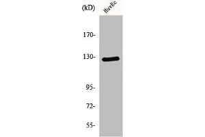 Western Blot analysis of HuvEc cells using MSH3 Polyclonal Antibody (MSH3 抗体  (N-Term))