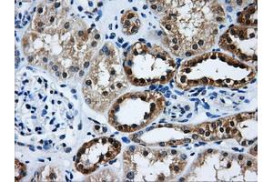 Immunohistochemical staining of paraffin-embedded Kidney tissue using anti-GBE1 mouse monoclonal antibody. (GBE1 抗体)