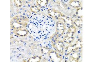 Immunohistochemistry of paraffin-embedded Rat kidney using SCG3 Polyclonal Antibody at dilution of 1:100 (40x lens). (SCG3 抗体)