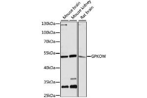 Western blot analysis of extracts of various cell lines, using GPKOW antibody (ABIN6293325) at 1:3000 dilution. (GPKOW 抗体)