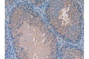 Detection of MAPK7 in Mouse Testis Tissue using Polyclonal Antibody to Mitogen Activated Protein Kinase 7 (MAPK7) (MAPK7 抗体  (AA 185-419))