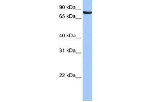 WB Suggested Anti-UBQLN3 Antibody Titration: 0. (Ubiquilin 3 抗体  (N-Term))
